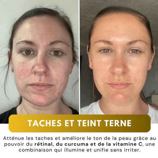 LumiGlow™ – Masque Facial Coréen au Curcuma et au Collagène