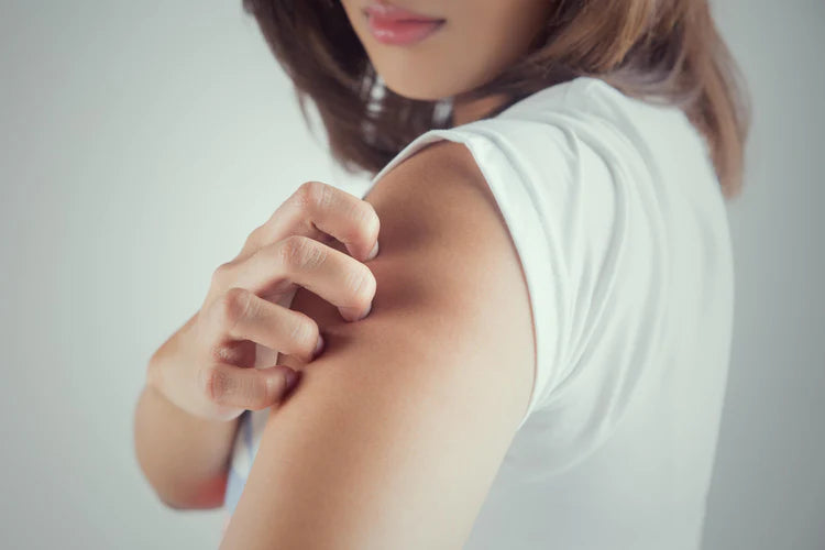Femme touchant son bras présentant des signes de kératose pilaire