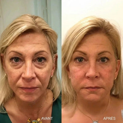 Moment V-Sculpt