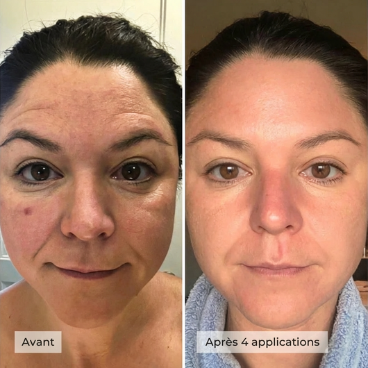 Hoysi – Masque Boosting au Collagène