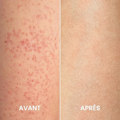 SilkPeel