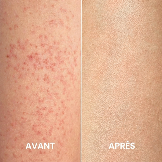 SilkPeel