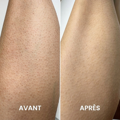 SilkPeel